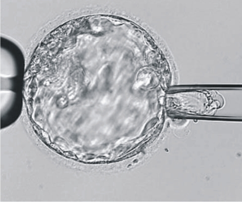 胚胎着床前染色体筛检(PGS)‧胚胎着床前基因诊断(PGD)