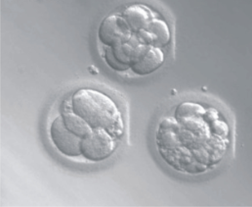 胚胎培养/雷射胚胎辅助孵化术